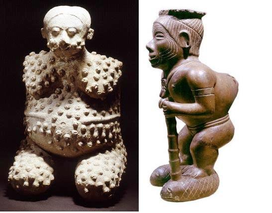 Representación de individuo enfermo y con deformación en columna. Cultura Nayarit. Museo Regional de Nayarit.